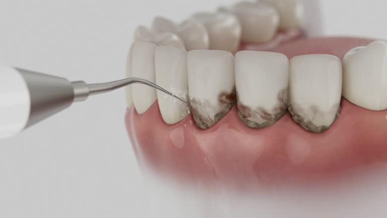 Reliable Dental Implants contractor in Forest City, PA by Smile Center Dentistry
